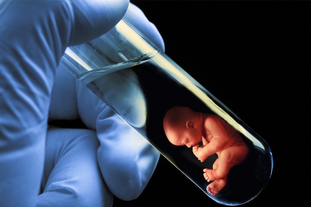 Best IVF Specialists in Delhi with High Success Rates.