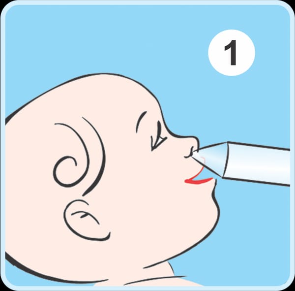 nasobuddy nasal aspirator